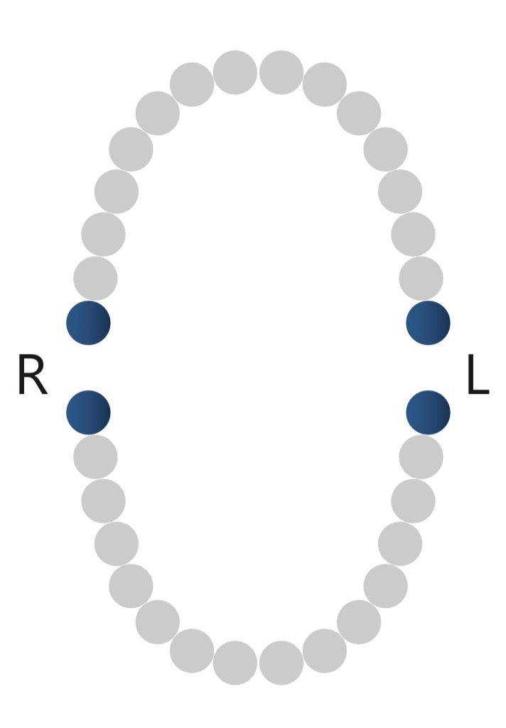 مشبك الحاجز المطاطي DENTECH KSK Distal - 3