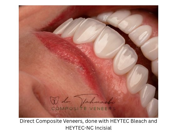 HeyTEC Bleach / Bleach-X Ceramic Hybrid Composite - 2